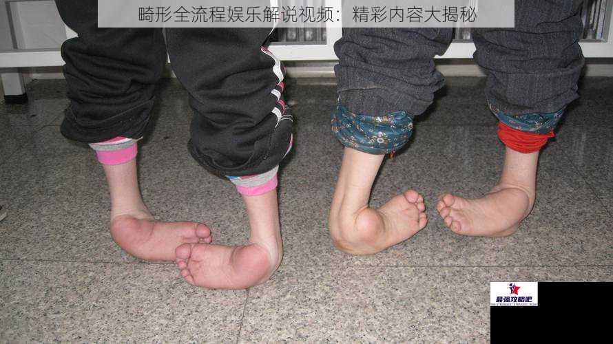 畸形全流程娱乐解说视频：精彩内容大揭秘